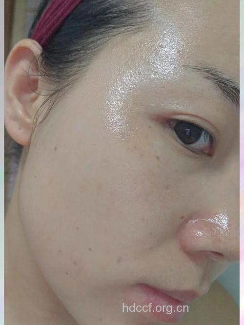 五类汁水美白脸部皮肤