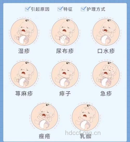 夏天婴幼儿常见皮肤病及防治措施