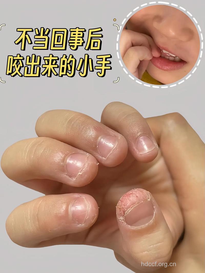 孩子喜欢咬手指正常吗