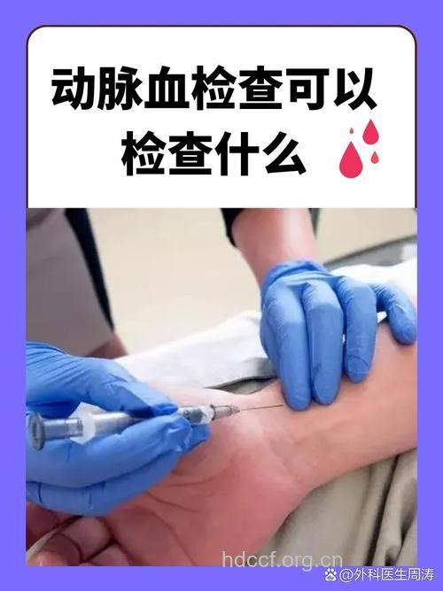 动脉硬化应该做的五种检查