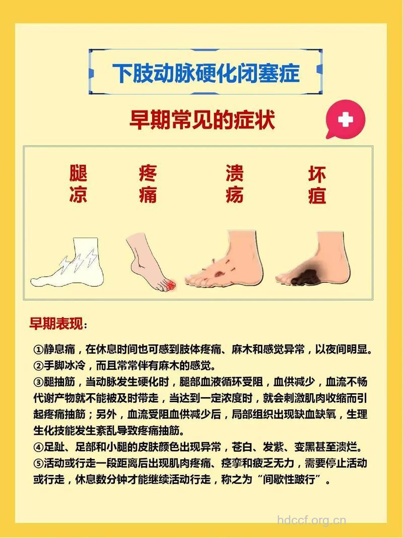 动脉硬化闭塞症诊断方法