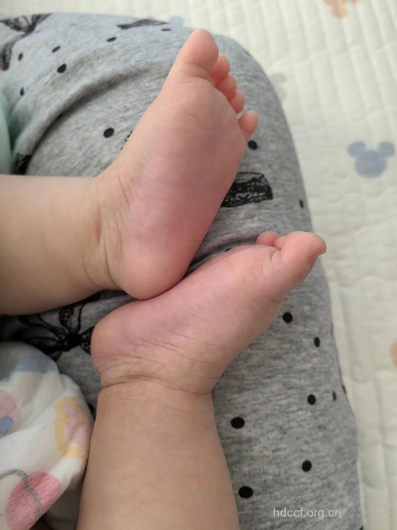 儿童赤脚可加快脑部发育