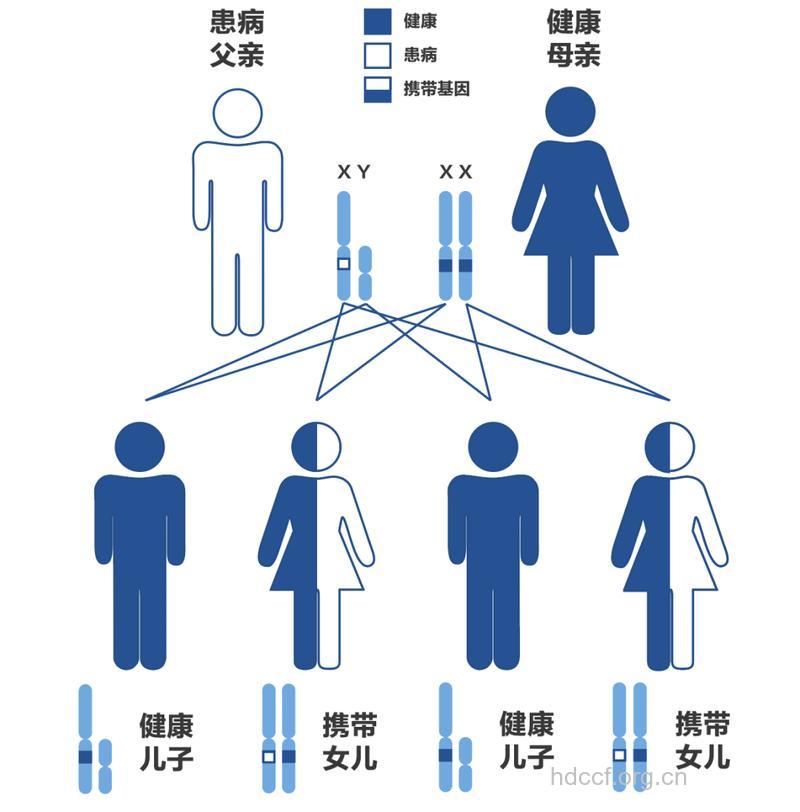父母容易遗传的七种疾病