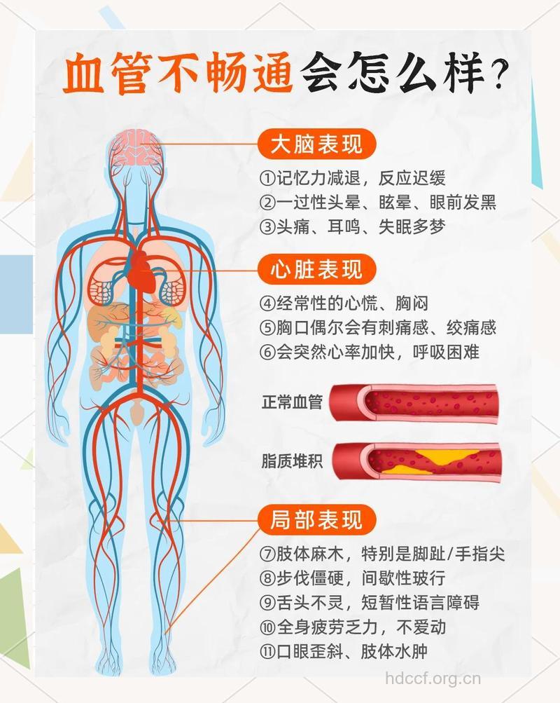 老年人如何轻松应对动脉硬化