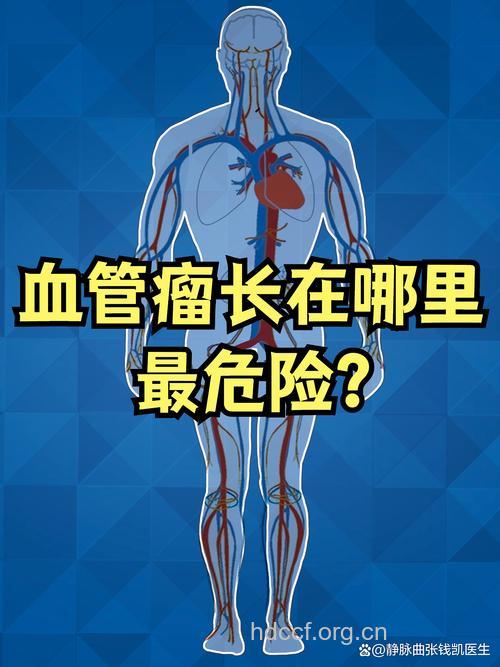 动脉粥样硬化血管可能会长“瘤”