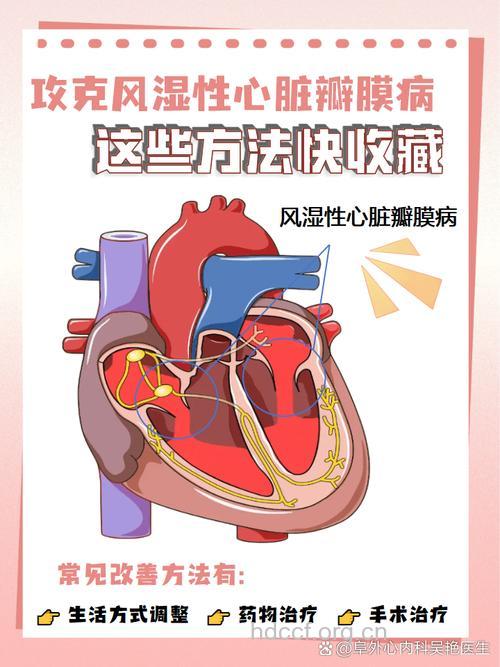 风湿性心脏瓣膜病的4种治疗方法