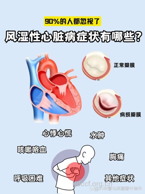 风湿性心脏辨膜病并发症