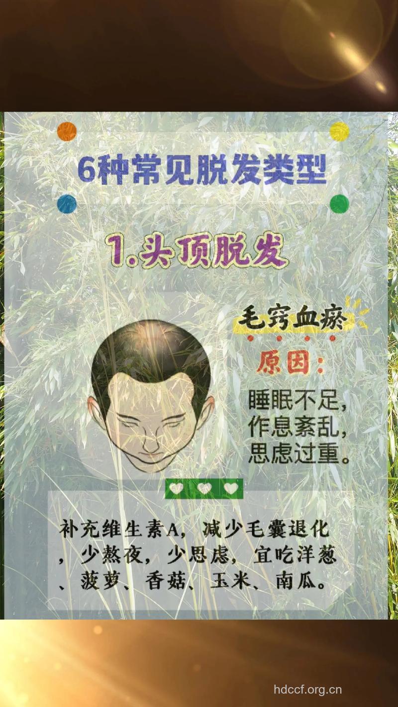 老人为何脱发 5个原因诱发