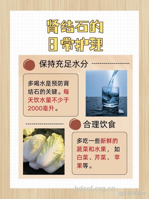 女性肾结石的五种早期症状及饮食禁忌
