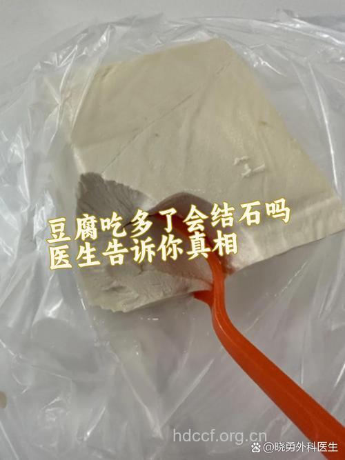 关于豆腐是否会致肾结石的真相