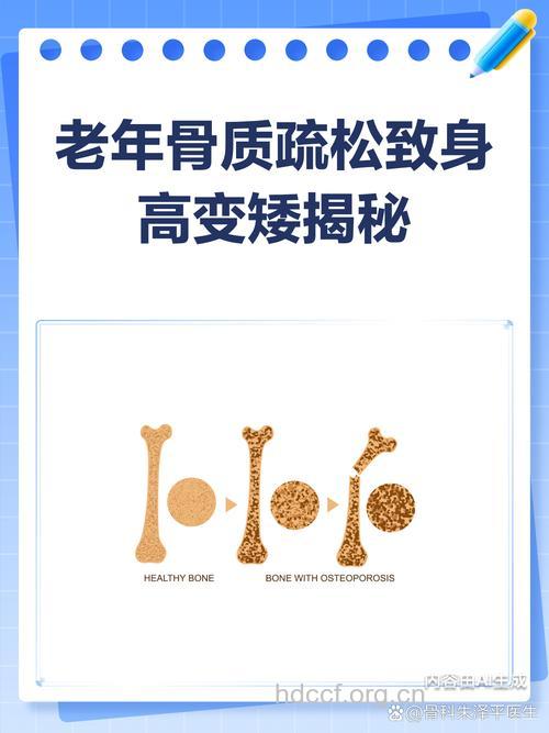 老人会变矮？ 或是骨质疏松在作祟
