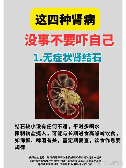 不爱喝水易得肾结石 女性患肾结石有哪些症状