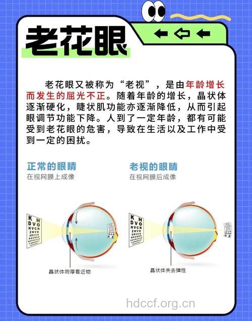 导致老花眼的原因是什么