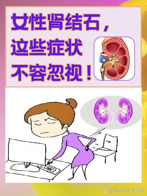 女性肾结石患者的临床表现是什么呢