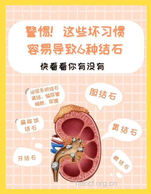 泌尿系结石有哪些危害