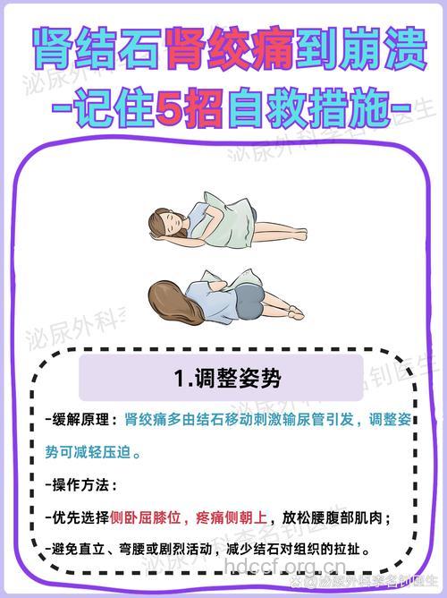 怎么应对肾绞痛方法