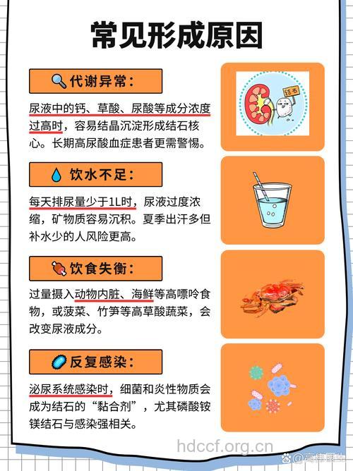 肾结石 夏季形成冬季发病