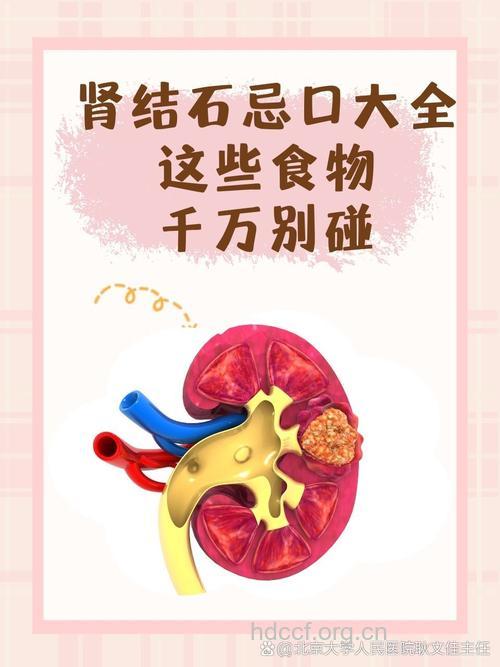 肾结石不宜做的8件事