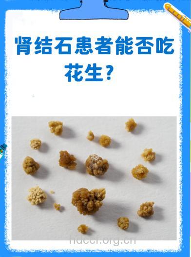 每天四瓶水冲走肾结石 胡桃仁粥溶解结石