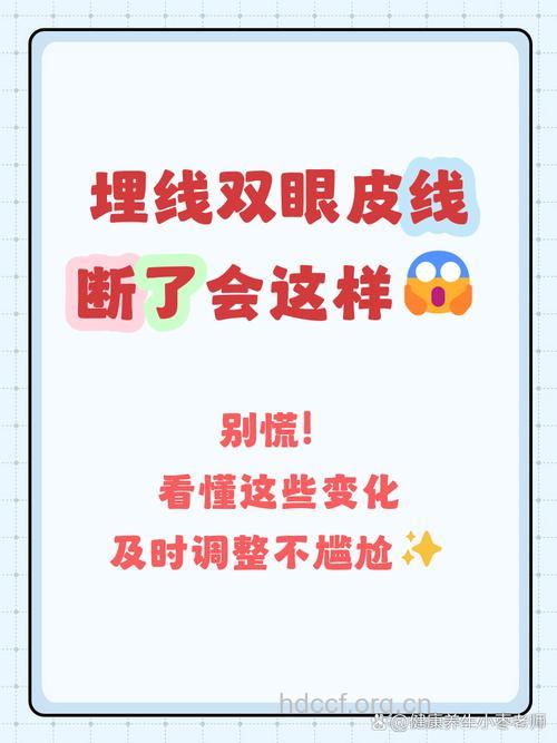 埋线双眼皮会出现断线的情况吗？