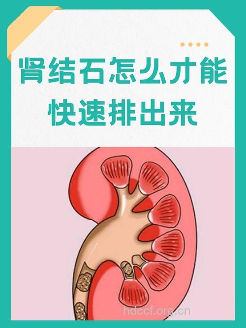 孩子可能患肾结石的三个信号