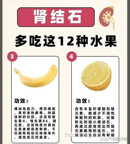 过量吃橘子易引起肾结石