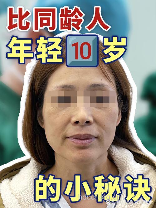 自体脂肪丰下巴虽好 这些并发症别忽视