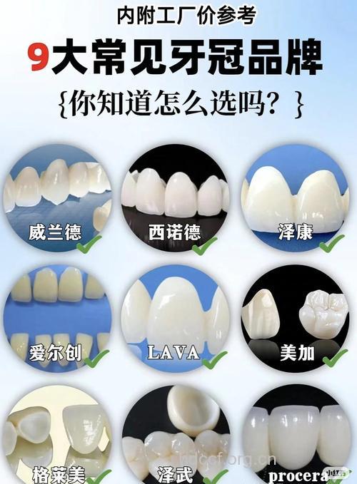全瓷牙有哪些优点 自然逼真