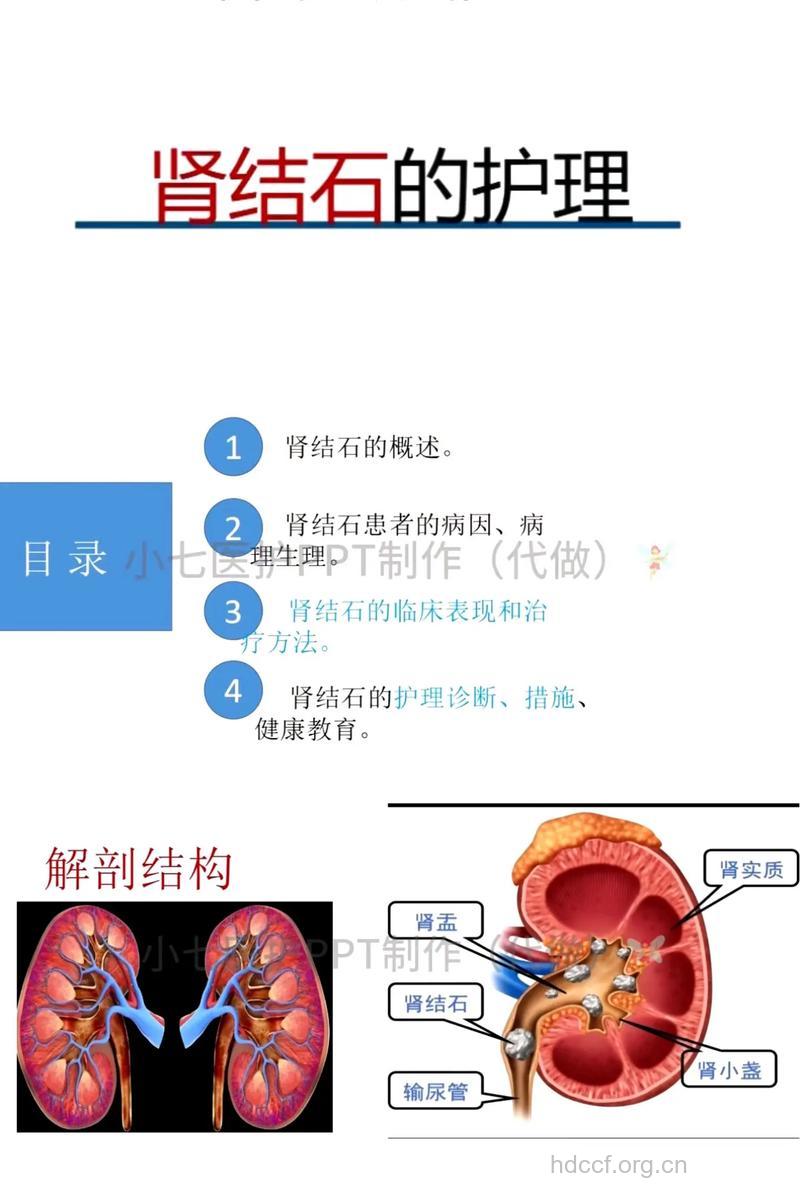 肾结石患者有什么护理方法