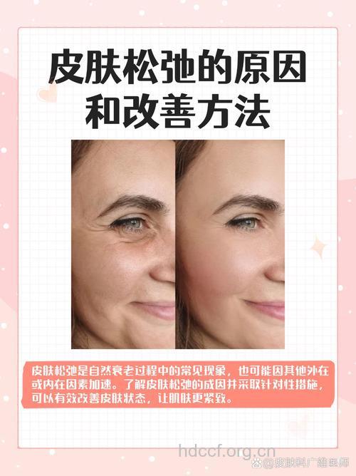 生物除皱改善皮肤状态 肌肤松弛不能做