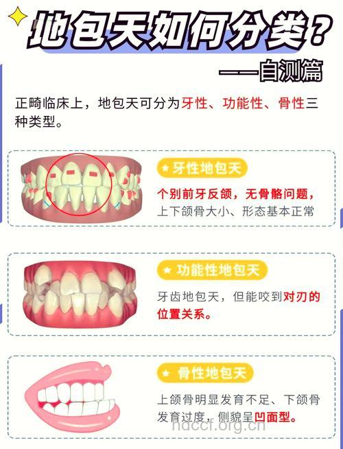 地包天有哪些矫正方式 两种方法可选