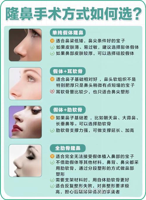 隆鼻手术有几种方法 选择适合最重要