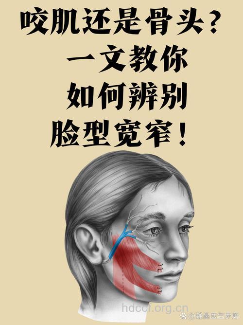 整形科普:咬肌肥大矫正安全吗?