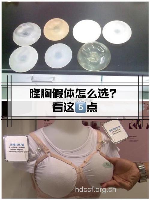 假体隆胸手感怎么样?自然柔软