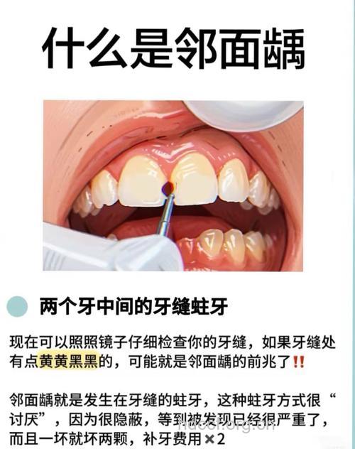 牙齿发黄发黑怎么办?推荐几个美牙方法