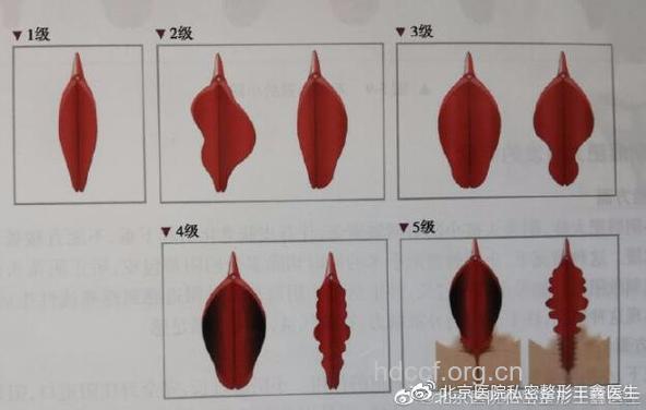 女性私密整形有哪些项目？