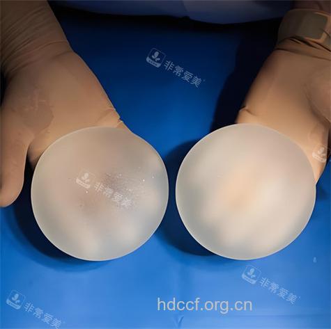 专家解读：硅胶丰胸安全吗？