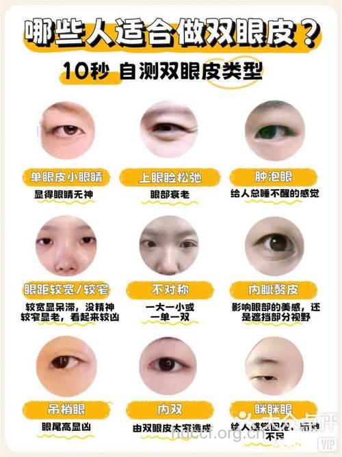 埋线双眼皮都适合所有人吗?