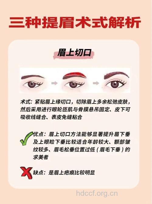 盘点眉部整形的手术方法