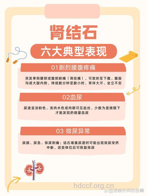 肾结石最显著特征：绞痛