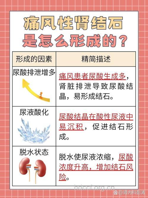 为什么痛风患者容易得肾结石