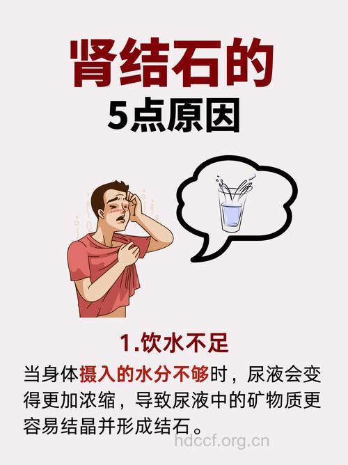 饮水不足是导致肾结石的病因