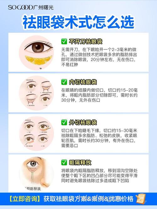 祛眼袋的最佳方法 四种手术减轻眼睛负担