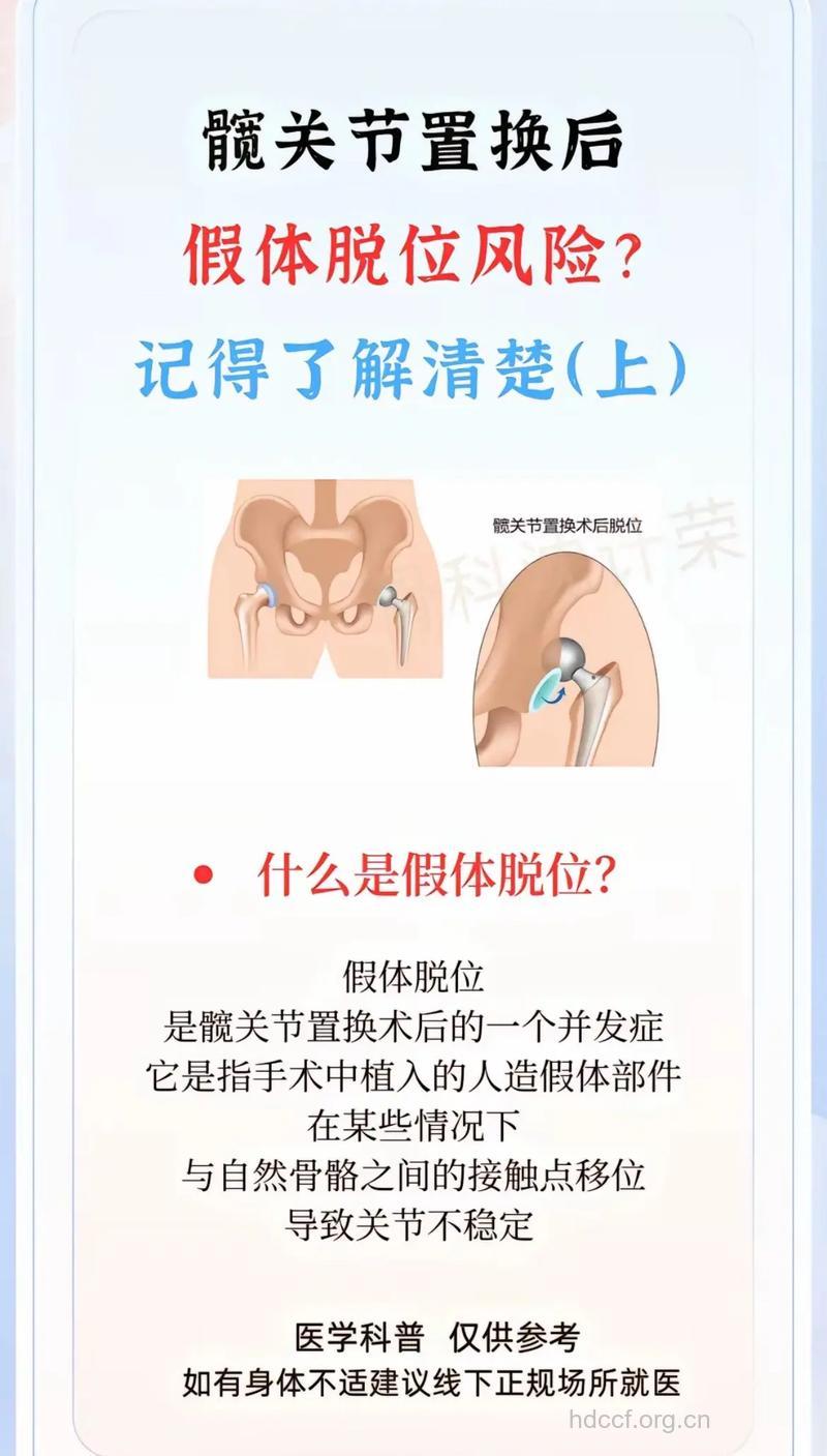 臀部植入假体会爆炸吗 注意5大禁忌