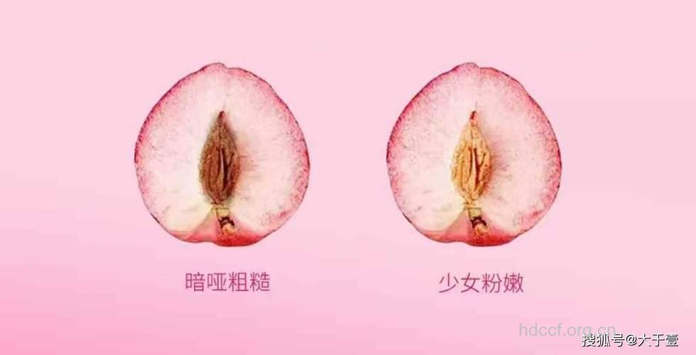 女性生殖整形手术 绽放私处美