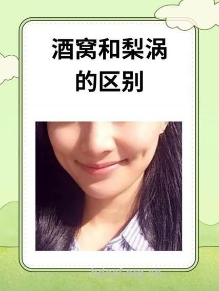 想要拥有可爱的酒窝吗 2种方法帮你实现