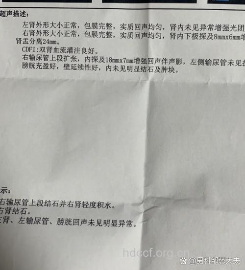 肾结石的诊断及治疗