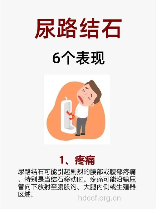 须知：泌尿系结石的三大症状