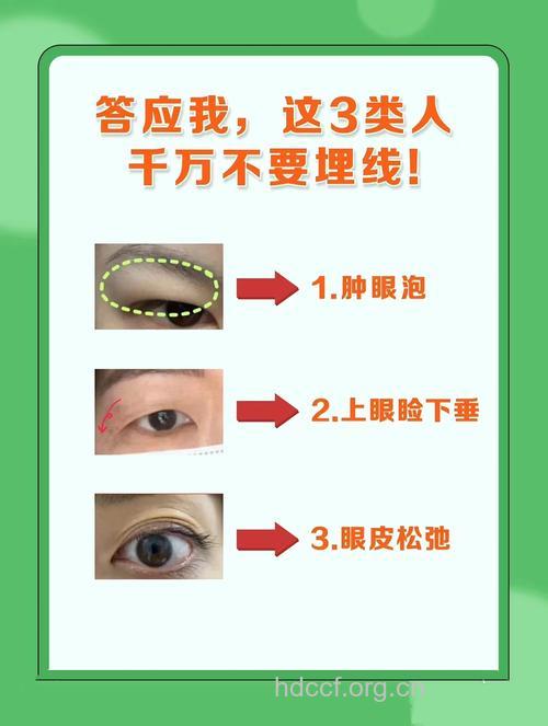 哪些人不宜做埋线双眼皮