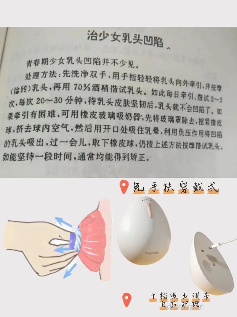 乳头内陷怎么办 推荐3种矫正方法